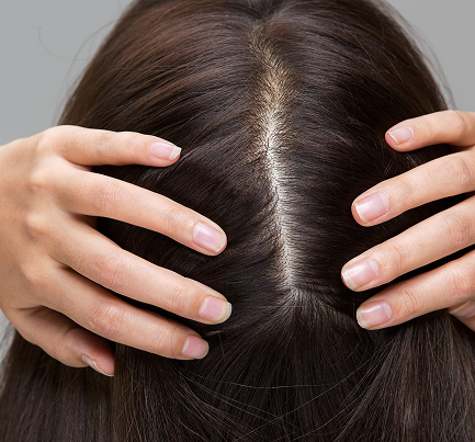 Woman’s hand resting on her scalp, highlighting the nourishing and soothing benefits of oil for scalp hydration and hair wellness —